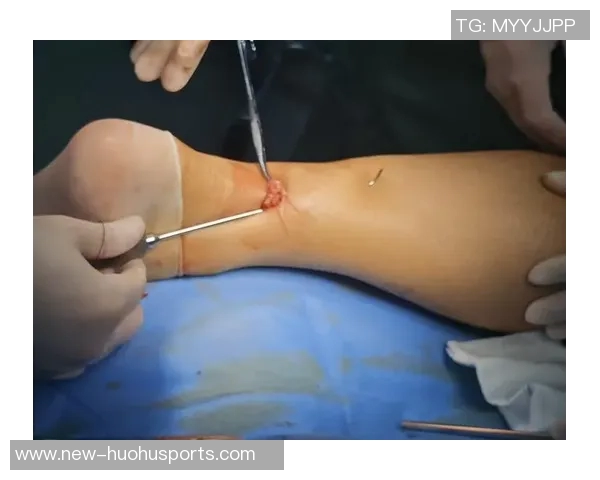 科瓦契奇本赛季仅出场两次将于明年三月重返赛场接受跟腱手术 科瓦契奇本赛季仅出场两次将于明年三月重返赛场接受跟腱手术